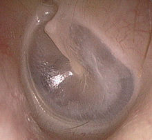 Woran Sehe Ich Ob Mein Jungefernhautchen Gerissen Ist Sex Scheide Jungfernhautchen Woran Sehe Ich Ob Mein Jungefernhautchen Gerissen Ist Sex Scheide Jungfernhautchen