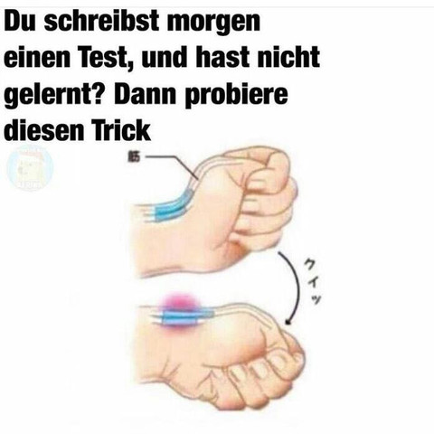 Man wie schmerzen brechen sich ohne kann den arm Rücken: Wenn