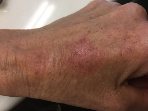 - (Gesundheit, Medizin, Schmerzen)