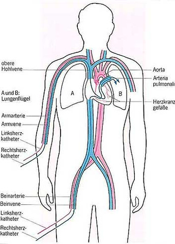 Wenn Man Jemandem Die Hand Abhackt Dann Verblutet Er Doch Oder Medizin Tod Unfall Wenn Man Jemandem Die Hand Abhackt Dann Verblutet Er Doch Oder Medizin Tod Unfall