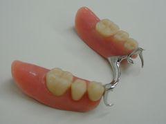 Bild 1 - (Zähne, Zahnarzt, Zahnersatz)