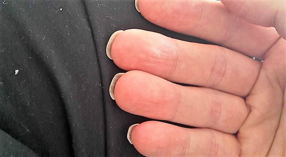 Nägel wachsen weiß nach? (Gesundheit und Medizin, Finger, Fingernägel)
