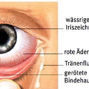 Augenschmerzen Was Nun Medizin Korper Arzt Augenschmerzen Was Nun Medizin Korper Arzt