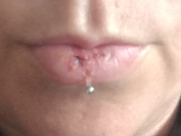 ashley piercing schmerzen nach dem stechen