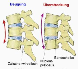 Bandscheibe - (Schmerzen, Rücken, Haartrockner)