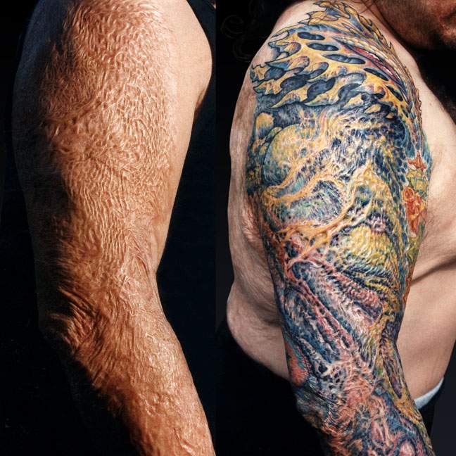 Kann man über Narben tätowierren? (Gesundheit und Medizin, Haut, Tattoo)