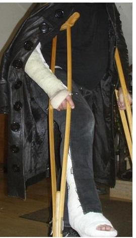 Wie lange kann man mit Krücken laufen, ich bin nur 10-15 Minuten ...