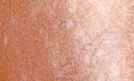 Die Creme von der Pigmentation von den Händen