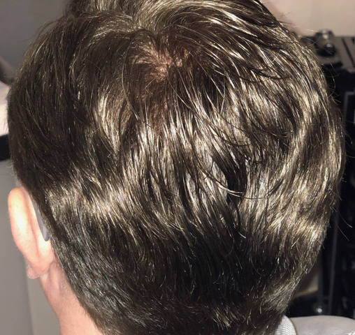 haarsysteme laterra erfahrung