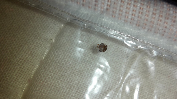 Ungeziefer Kot Im Bett Gesundheit Und Medizin Bettwanzen