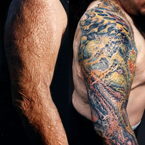 Darf Man Vernarbte Tattoos Nachstechen Oder Ist Das Ein Risiko Durch Welches Sie Noch Vernarben Konnen Tattoo Darf Man Vernarbte Tattoos Nachstechen Oder Ist Das Ein Risiko Durch Welches Sie Noch Vernarben Konnen Tattoo