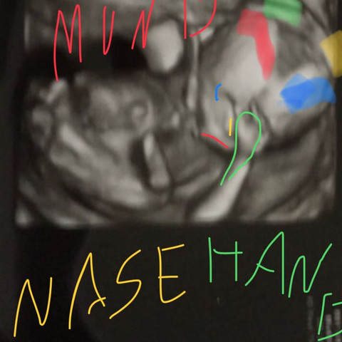 16 Ssw 3d Ultraschall Kopf Sieht Komisch Aus Schwangerschaft Baby