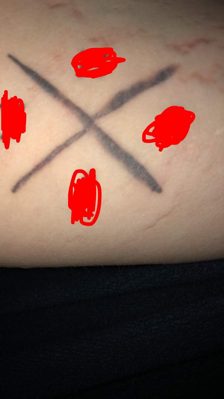 Ist mein Tattoo ein Blowout?