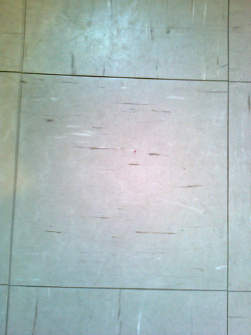 Asbest Eingeatmet Wer Kennt Leute Die Uber Jahren Nach Exposition Noch Leben Lungenkrebs