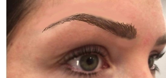 Entfernen Von Microblading 3 Monate Nach Dem Stechen