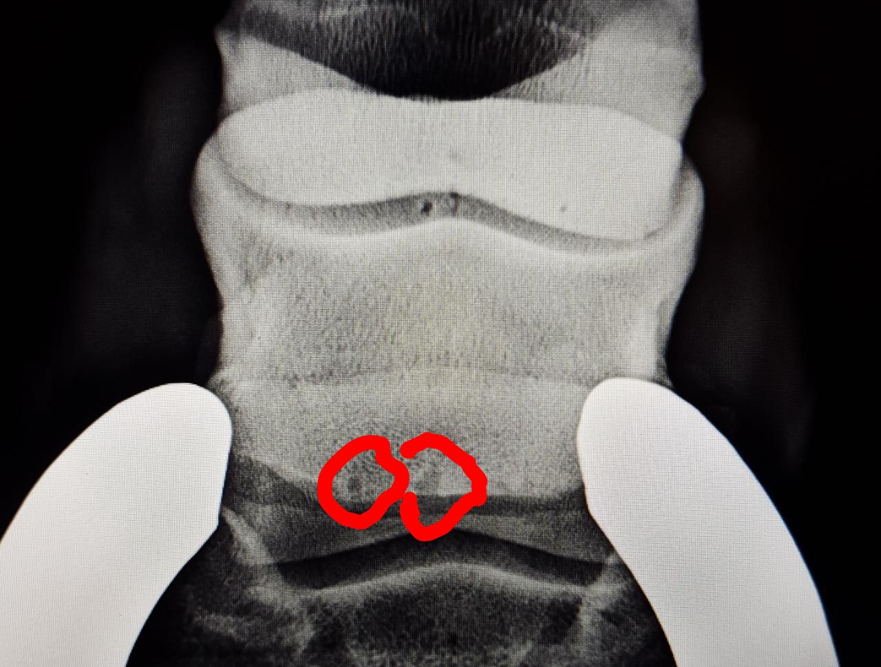 Hufrolle Röntgenbilder auswerten? (Pferde, Röntgenbild)