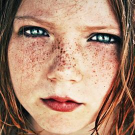 Nach dem Bestand des Wortes der Sommersprosse zu ordnen