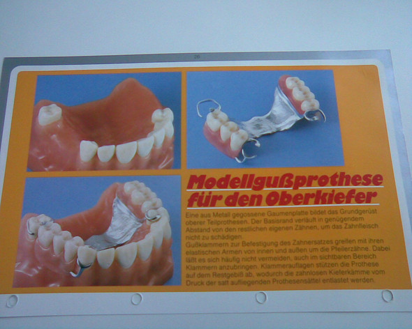  - (Gesundheit und Medizin, Zahnersatz, Barmer GEK)