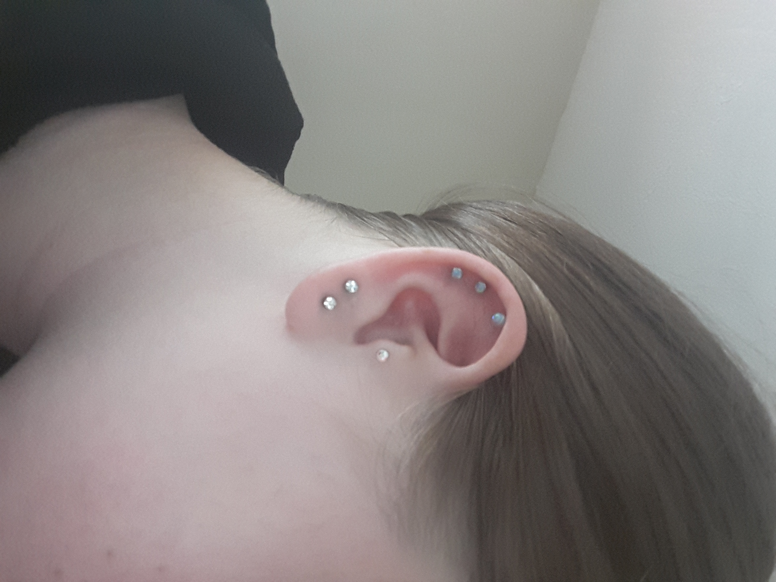 Tut Ein Helix Stechen Weh