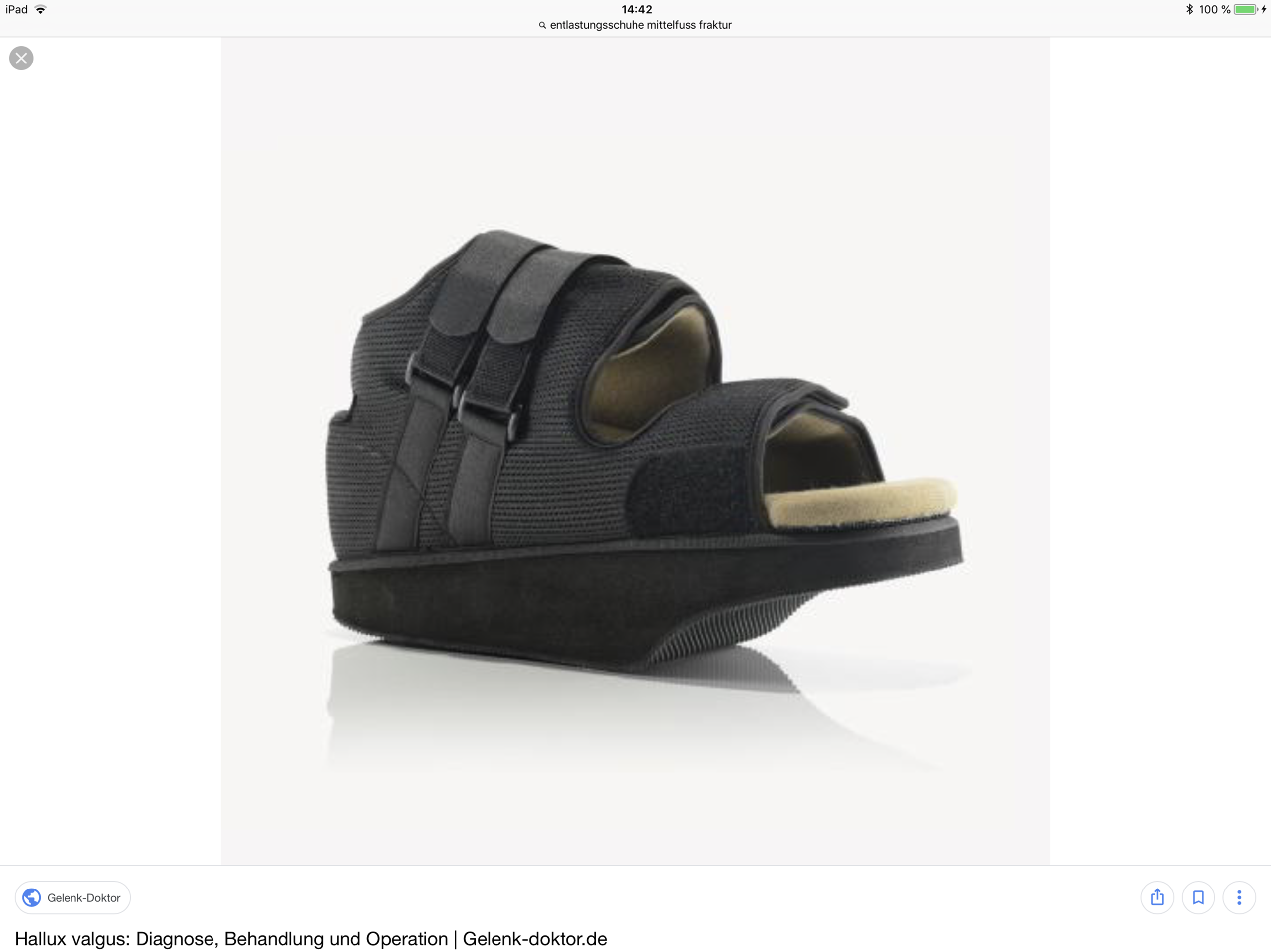 Gips bei Mittelfußbruch? (Gesundheit und Medizin, Schmerzen, Krankenhaus)