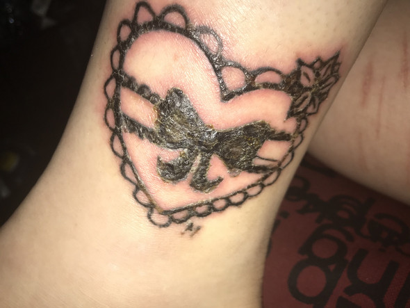 Was tun mit meinem 5Tage alten Tattoo HILFE? (Haut)