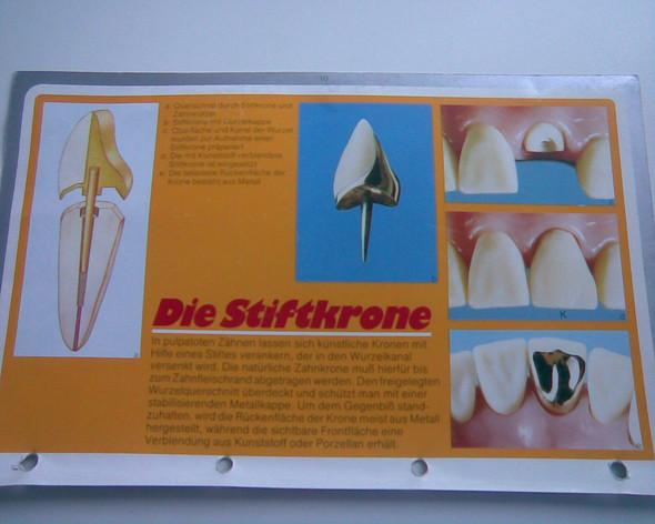 Wurzelbehandlung Kosten Zahnzusatzversicherung . Damit Hohe Zahnarztkosten Der Vergangenheit Angehören.