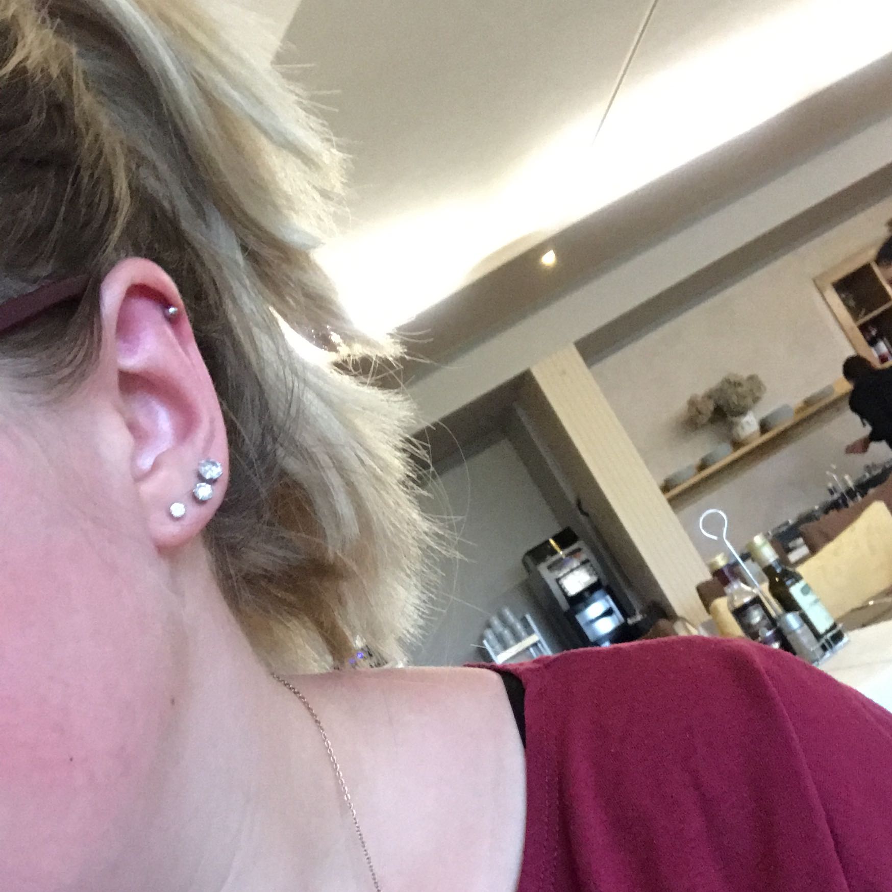 Tut Ein Helix Stechen Weh