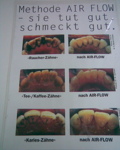 - (Gesundheit und Medizin, Zähne, Zahnarzt)
