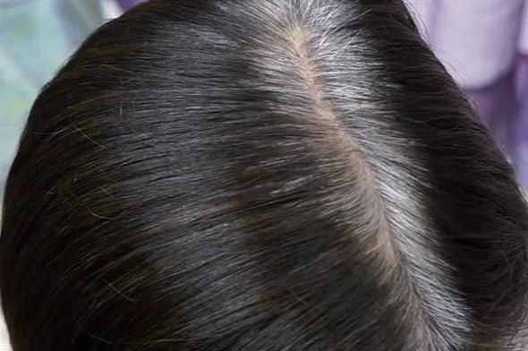 wass ist das auf der kopfhaut