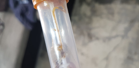 Sind Das Parasiten Im Stuhl Gesundheit Und Medizin