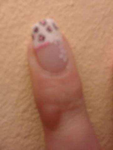 Schwiele links - (Finger, Hautkrebs, Schorf)