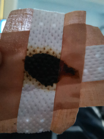 zugsalbe gelb am pflaster gesundheit