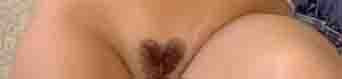 - (Gesundheit, Sex, Medizin)