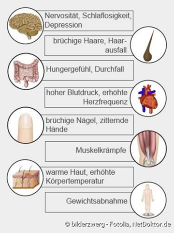 Bild zum Beitrag