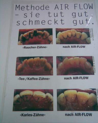 - (Gesundheit und Medizin, Zähne, Zahnarzt)