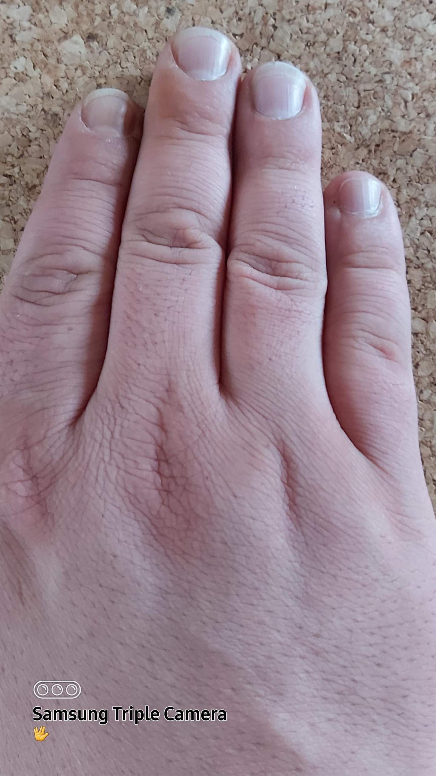 Je kürzer der Zeigefinger als der Ringfinger ist desto länger der penis
