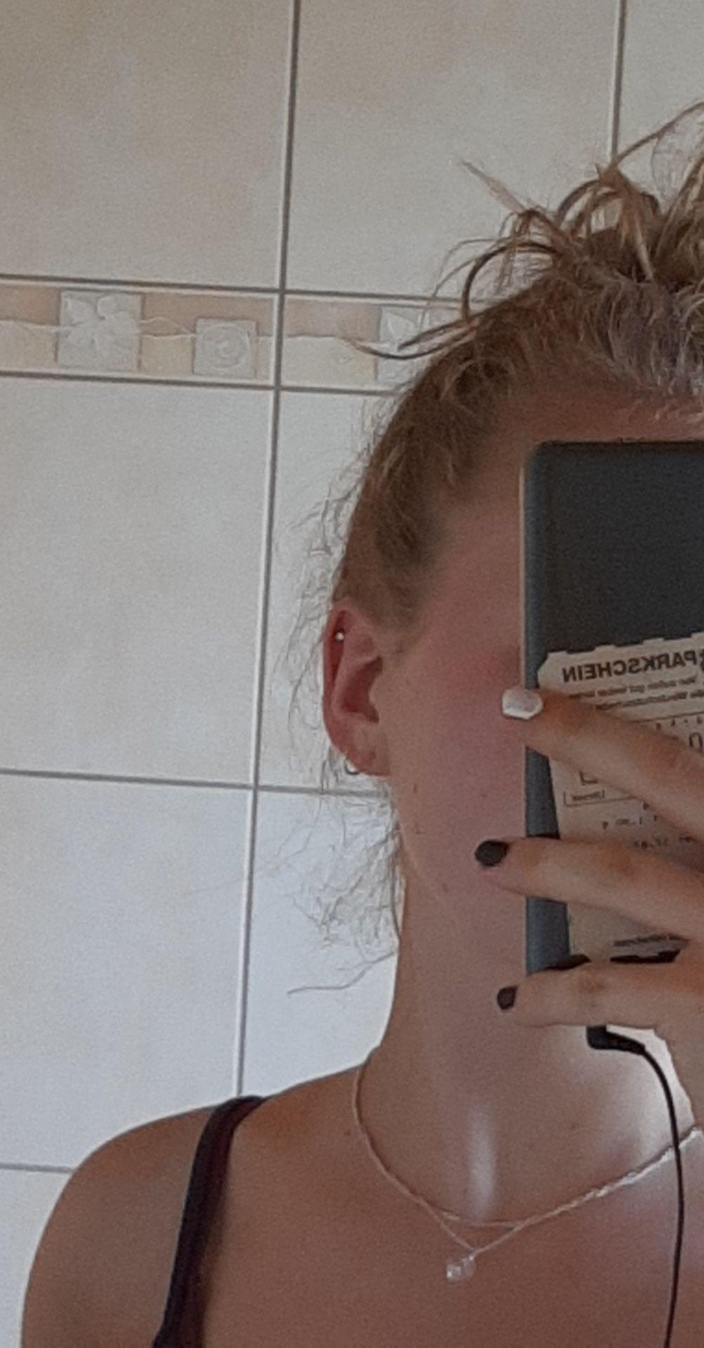 Tut Ein Helix Stechen Weh