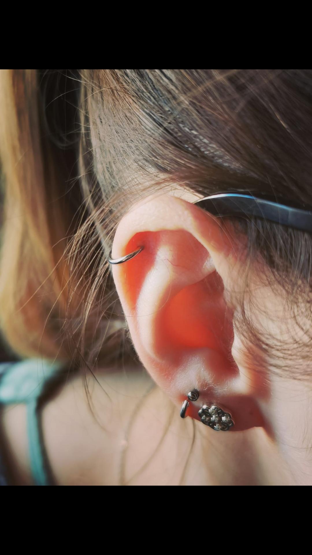 Tut Ein Helix Stechen Weh