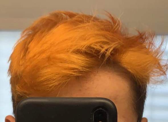 Haare Farben Bei Jungs Umfrage Abstimmung Aussehen