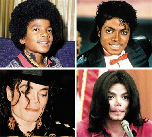 Warum Hat Michael Jackson Sich Weiß Gemacht