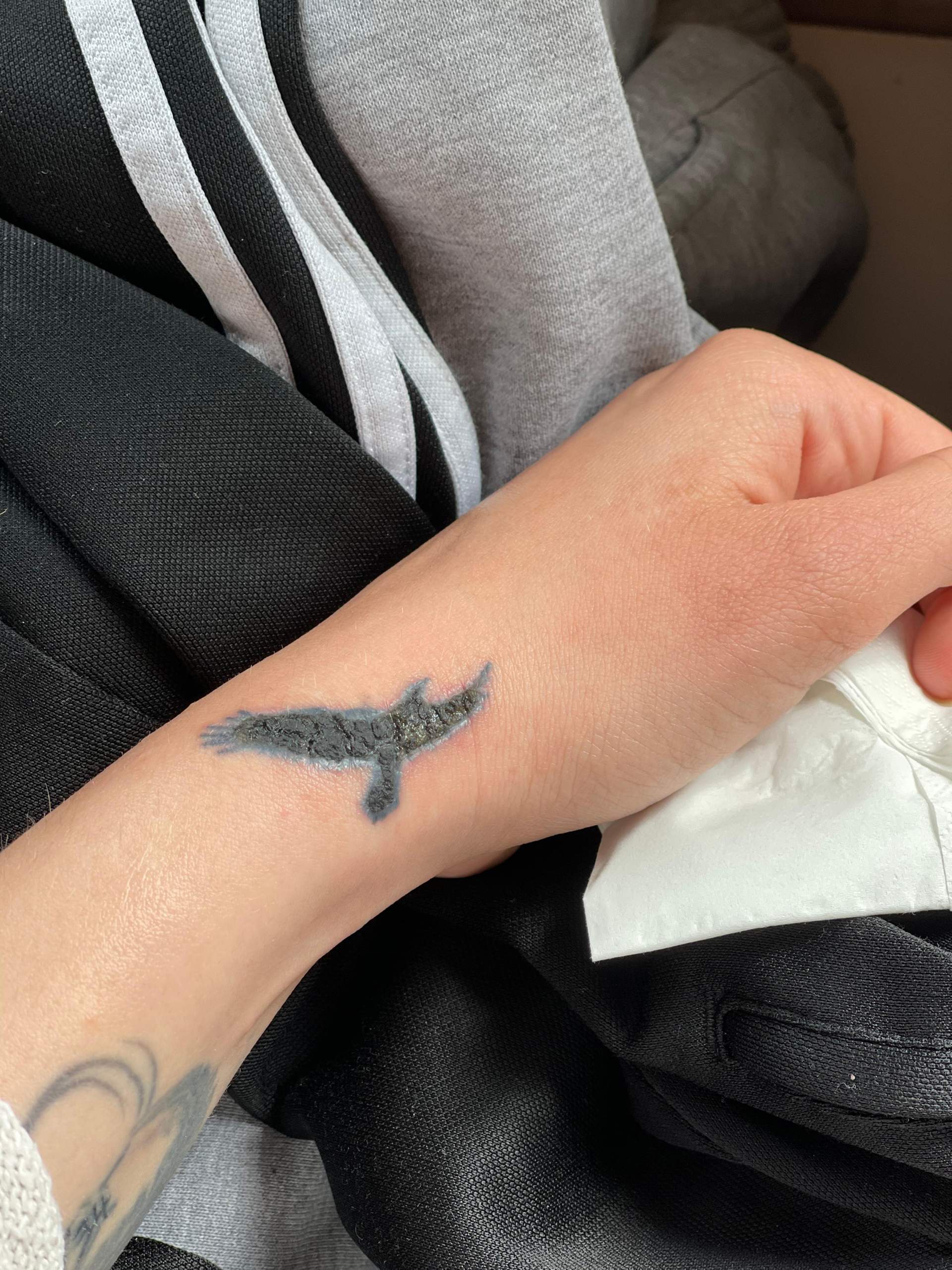 Tattoo kann es zur blutvergiftung kommen? (Gesundheit und Medizin, Blut)