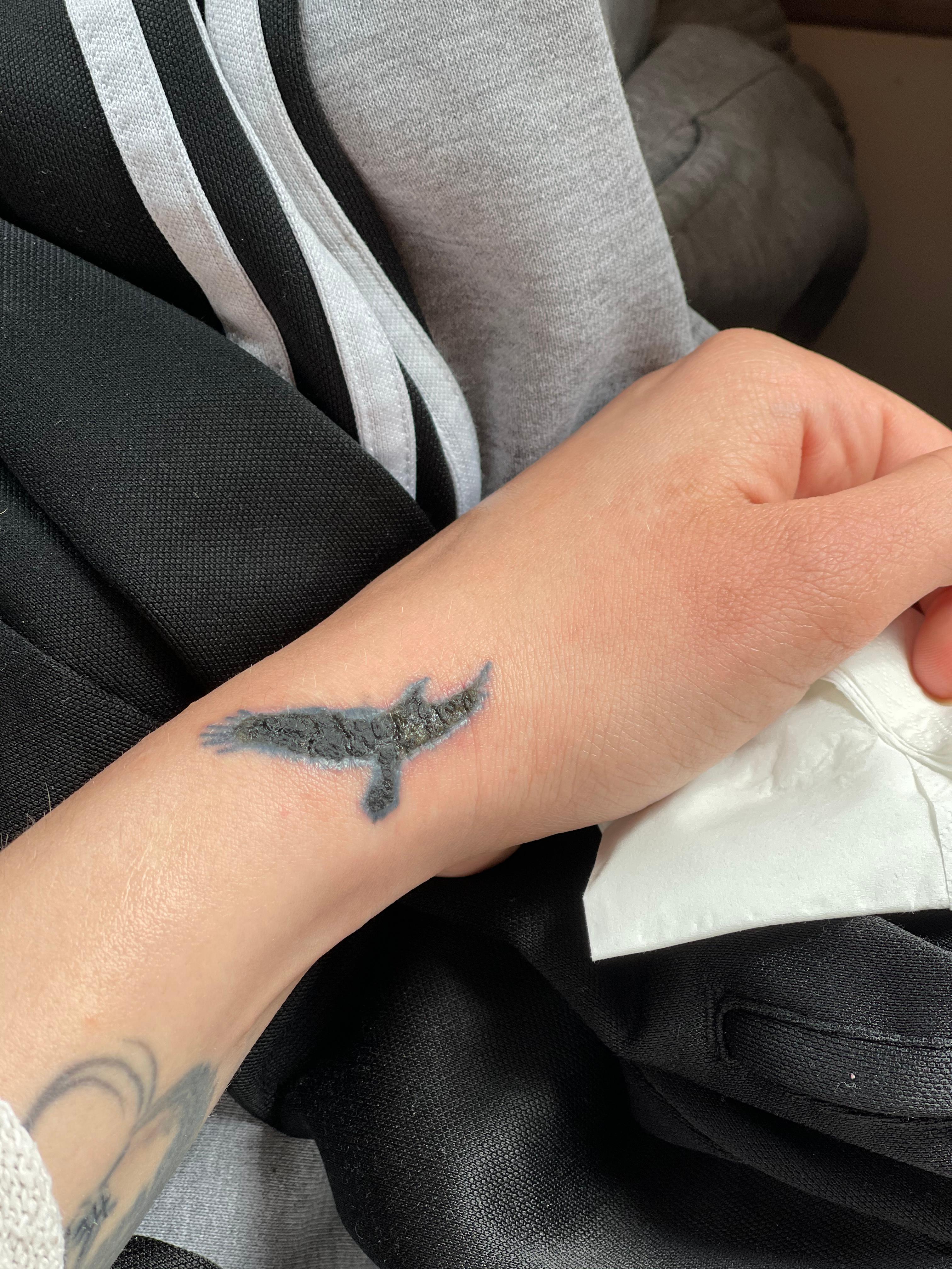Tattoo kann es zur blutvergiftung kommen? (Gesundheit und Medizin, Blut)