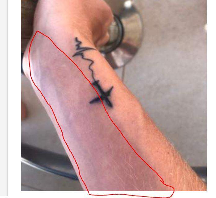 Tattoo zu tief gestochen? (Gesundheit und Medizin, Tattoopflege