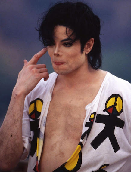 Warum Hat Michael Jackson Sich Weiß Gemacht