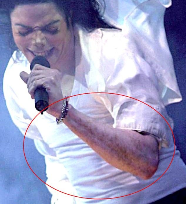 Warum Hat Michael Jackson Sich Weiß Gemacht