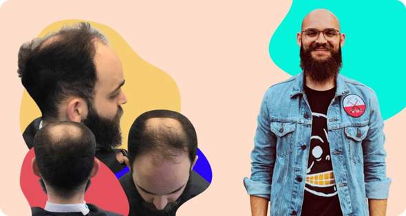- (Gesundheit und Medizin, Haare, Männer und Frauen)