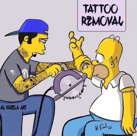  - (Tattoo, Tattooentfernung)