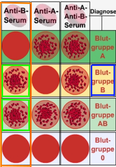 Blutgruppen Die Nicht Zueinander Passen Kinderwunsch Hilfe in Biologie (Blutgruppen)? (Schule, Lernen, Blut)