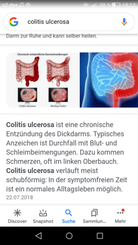  - (Gesundheit und Medizin, Colitis Ulcerosa, Infusionterapie )