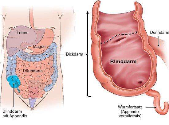 Ist der Blinddarm link oder rechts unten? (Gesundheit und Medizin, Körper)